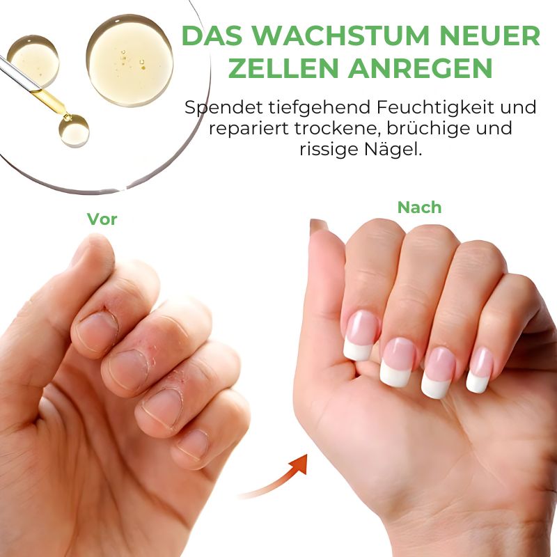NagelKur™ | Nagelpflegegel
