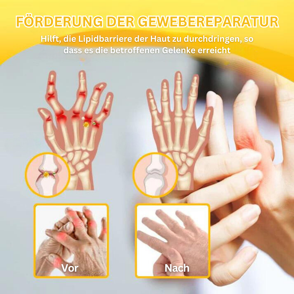 BienenGift™ | Fortgeschrittene Gelenk- und Knochentherapie-Creme
