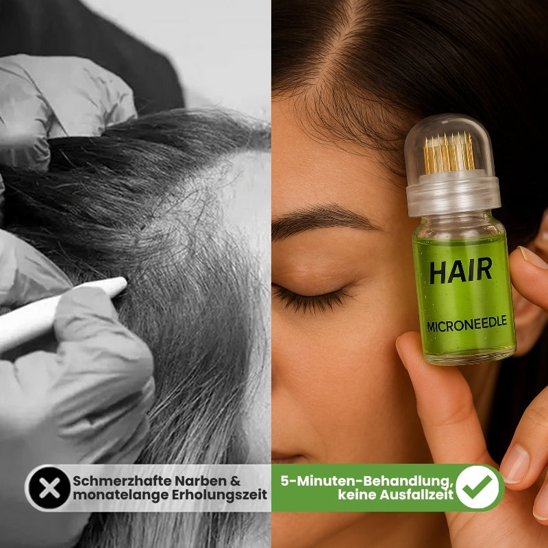 RootLuxe™ | Mikronadel-Haarwuchs-Set