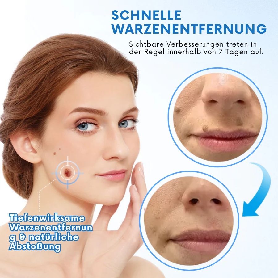 Tagiva™ | TagGone Warzenentfernungscreme