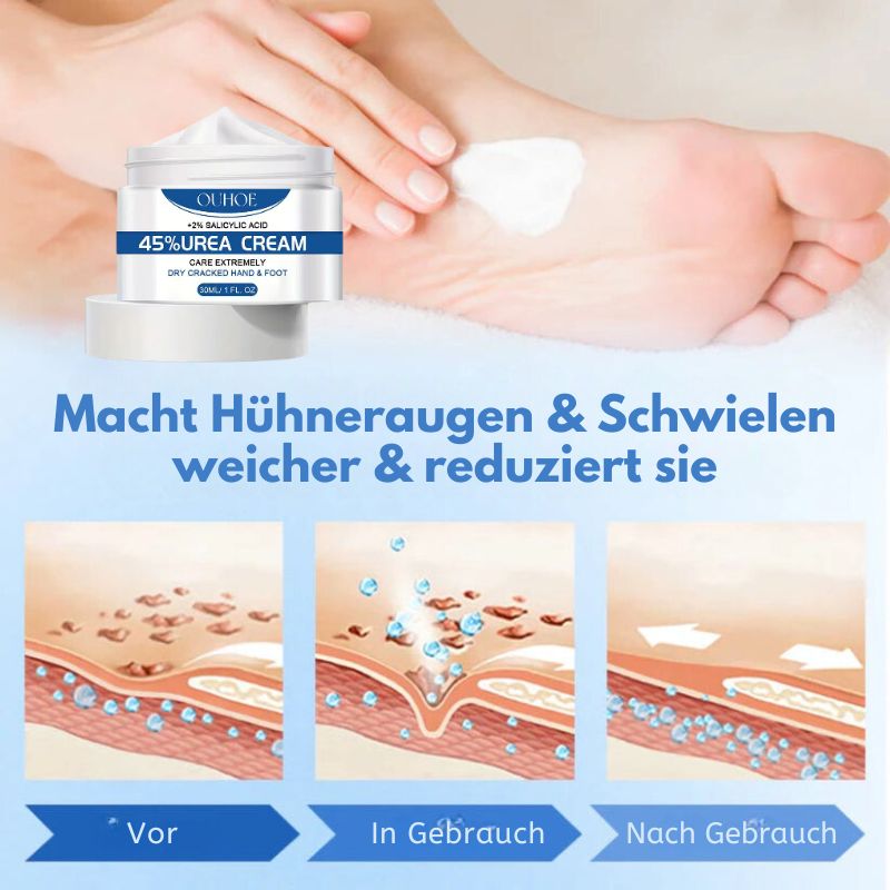 RisshautCreme™ | Creme zur Reparatur rissiger Haut