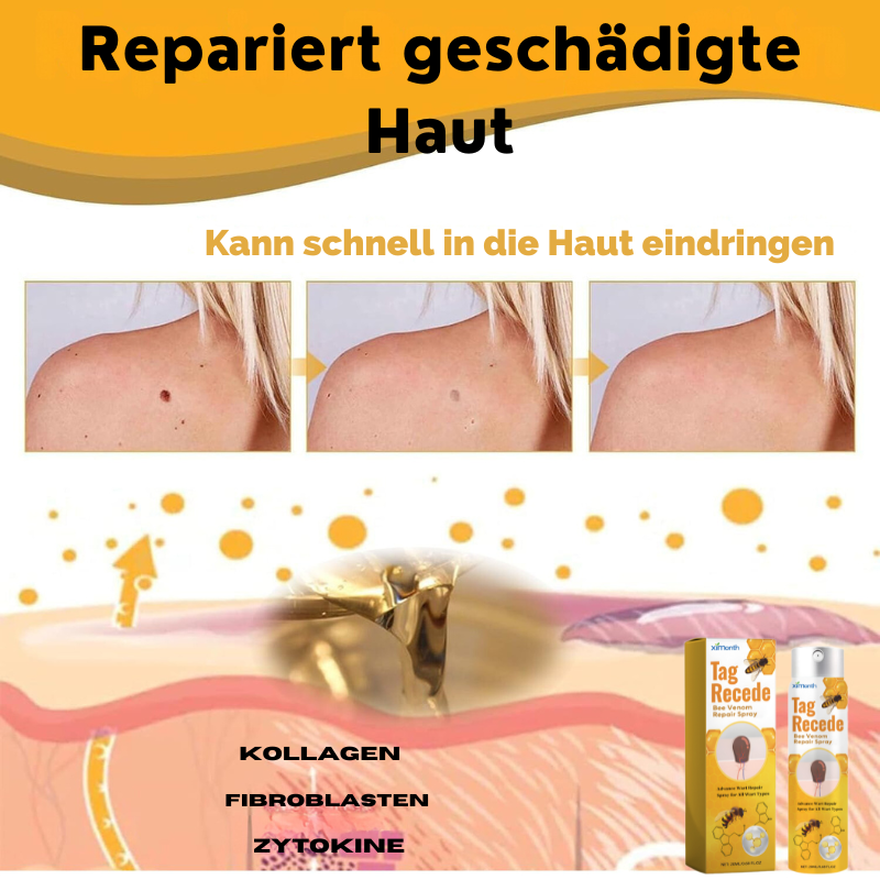 WarzenFrei™ | Verabschieden sich in nur 1 Woche von Hautflecken!