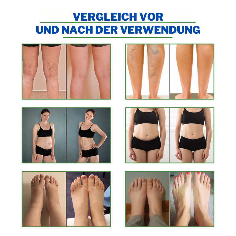 FitPflaster™ | Beginnen Sie in nur 4 Stunden abzunehmen!