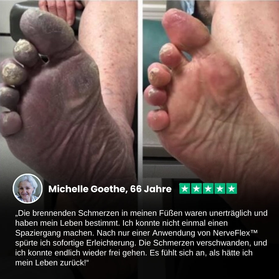 NerveFlex™ | Anti-Neuropathie-Gerät