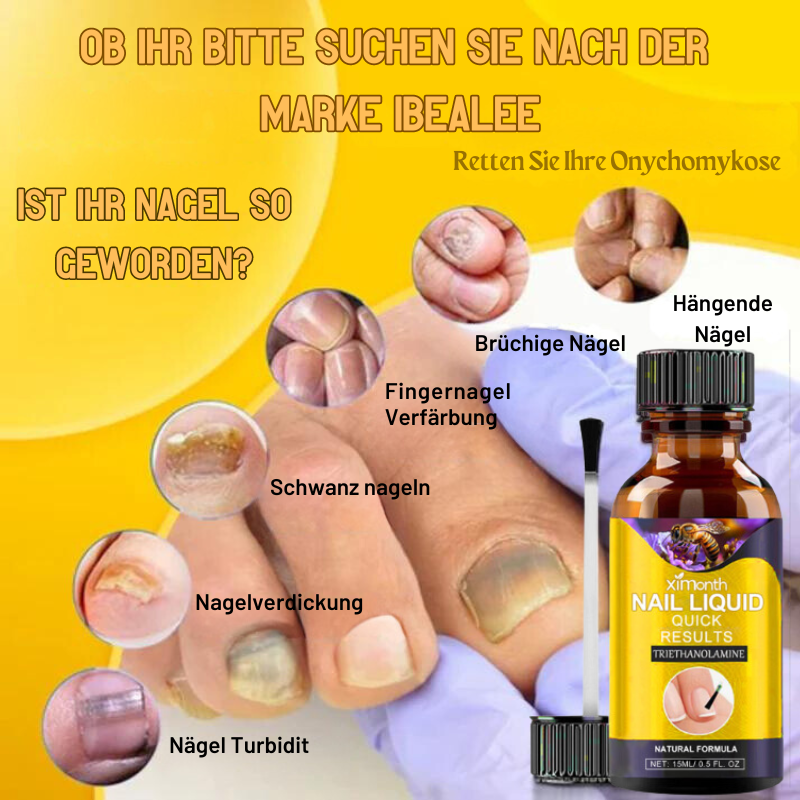 NagelPflege™ | Stellen Ihre hässlichen Nägel in nur 1 Woche wieder her!