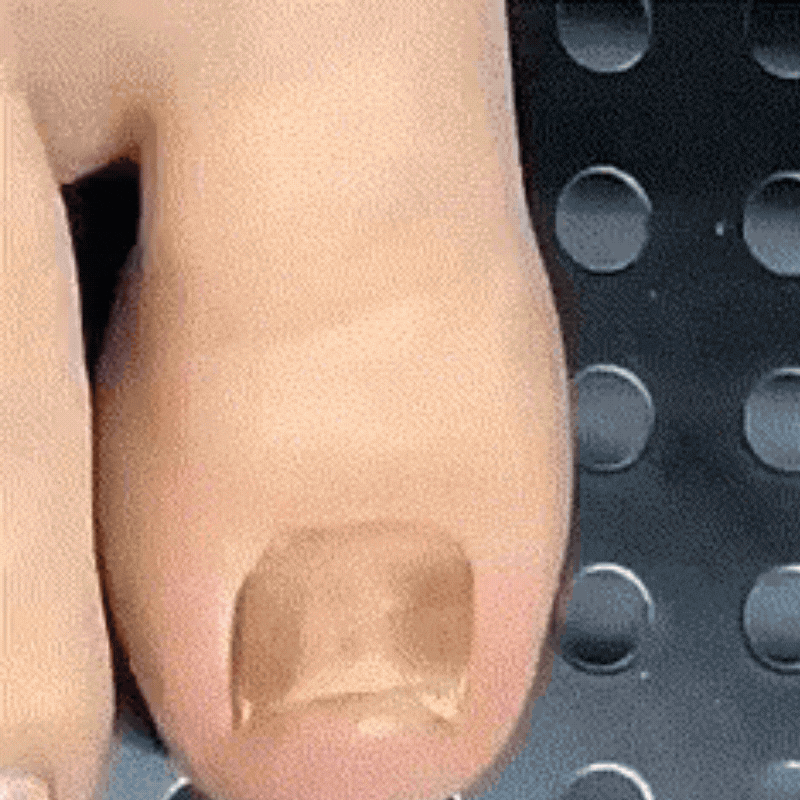NagelPflege™ Stift | Nagelstift zur Bekämpfung von Nagelpilz