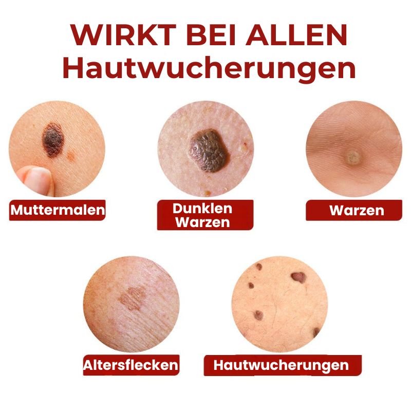 DermaFix™ | Serum-Stift zur Entfernung von Hautwucherungen und Muttermalen