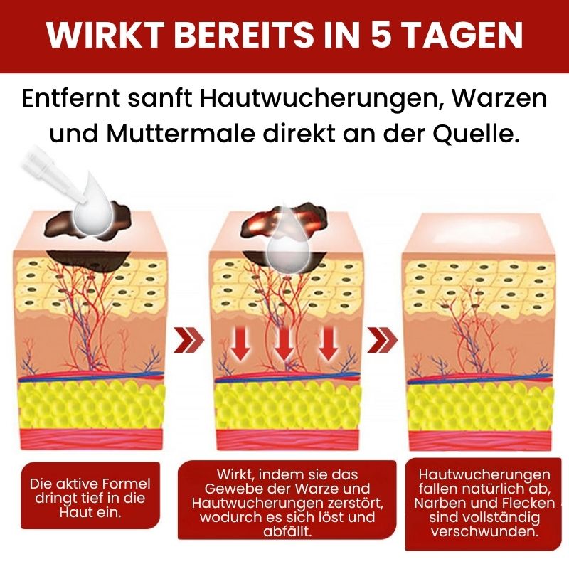 DermaFix™ | Serum-Stift zur Entfernung von Hautwucherungen und Muttermalen
