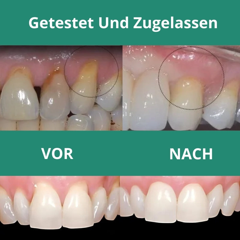 GummiHeil™ |  Zahnfleisch-Reparatur-Tropfen