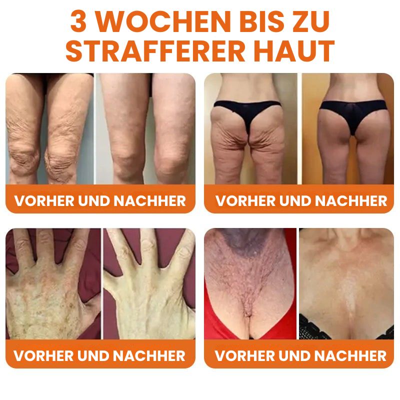 BienenStraff™ | Straffender Stick