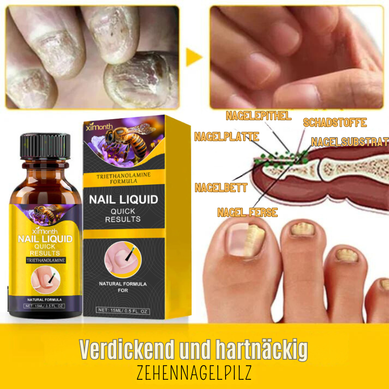 NagelPflege™ | Stellen Ihre hässlichen Nägel in nur 1 Woche wieder her!
