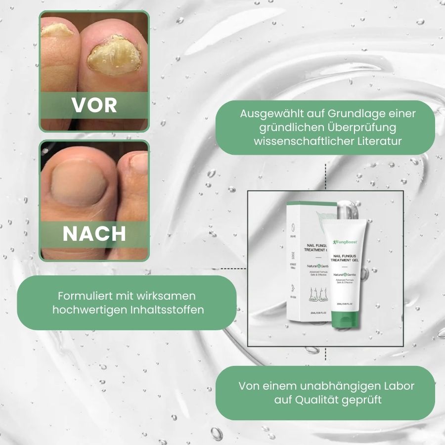 FungBoost™ | Nagelpilz-Behandlungsgel