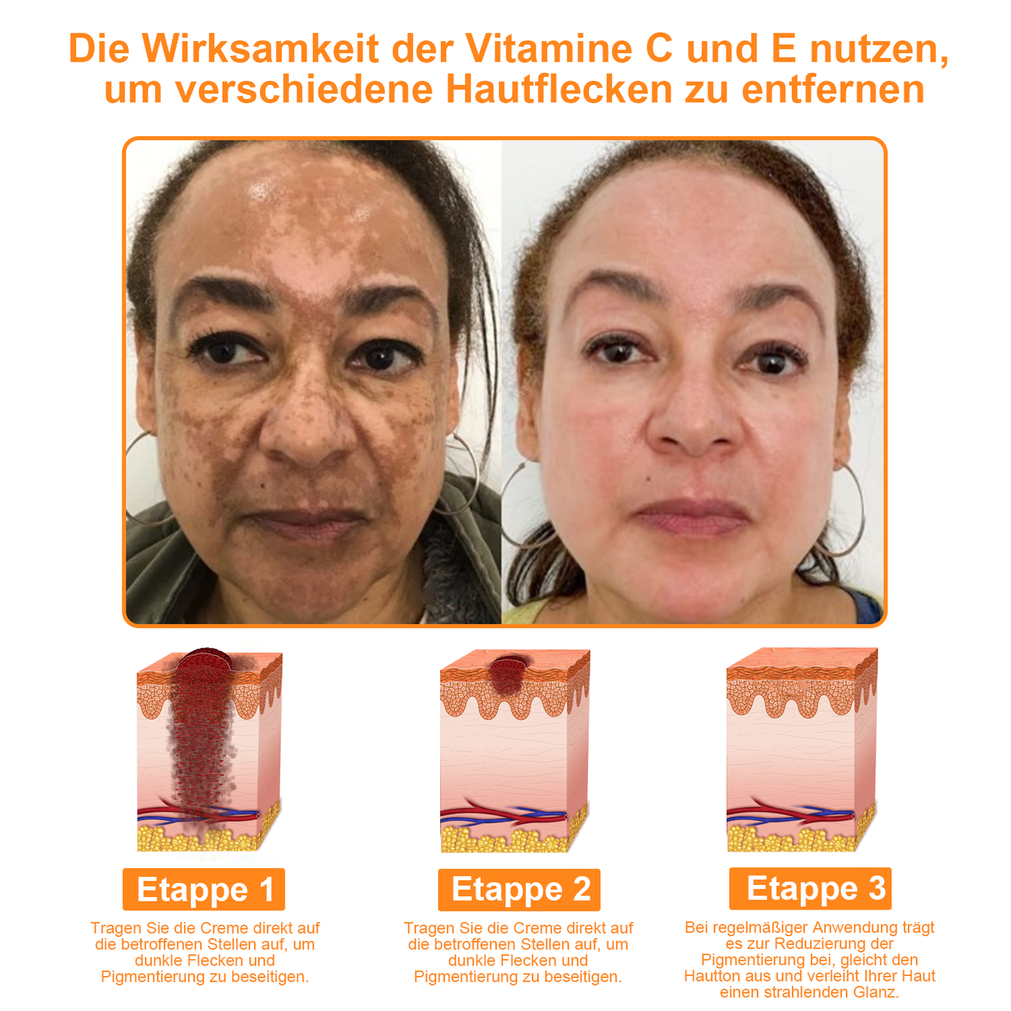 HautRepar™ | Leistungsstarke Ganzkörper-Hautpflegecreme (EADV-Empfehlungen)