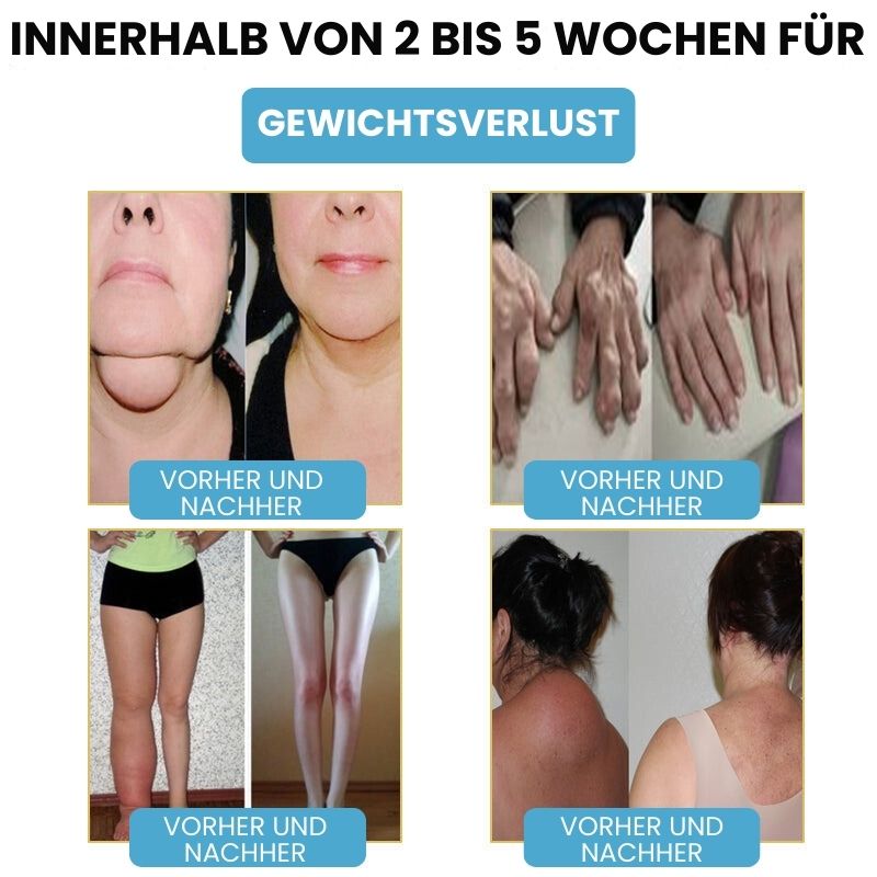 SlimPuls™ | Ultraschall-Detox-Armband für Fettverbrennung & Blutzuckerregulation