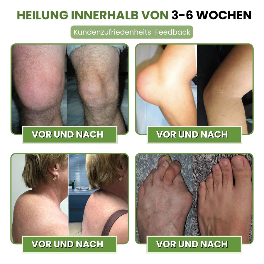 VenoJoint™ | Bienenstichgift-Gelenkregenerierungscreme