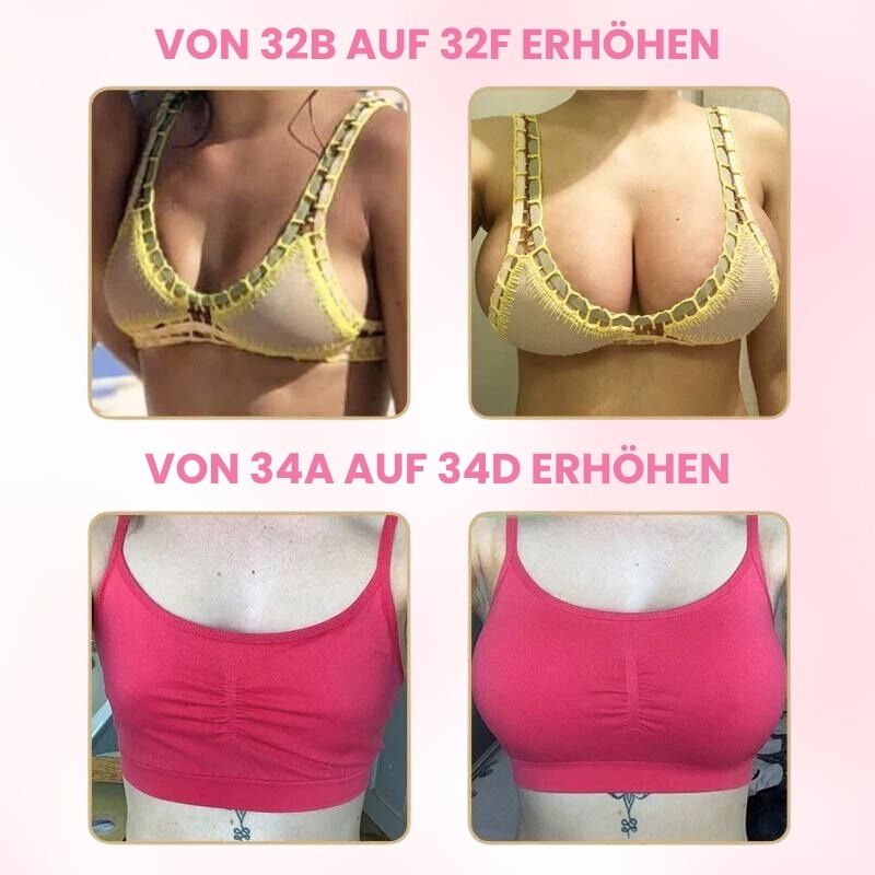 BusteNova™ | Bruststraffungsset