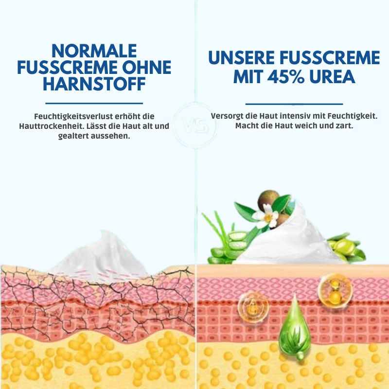 RisshautCreme™ | Creme zur Reparatur rissiger Haut