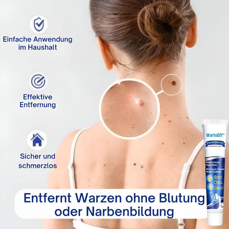 WartsOff™ | Entfernt Warzen sofort – schmerzlos