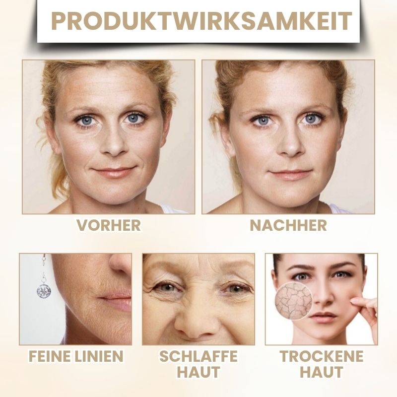 VitaLift™ | Rinderfett für Hautstraffung