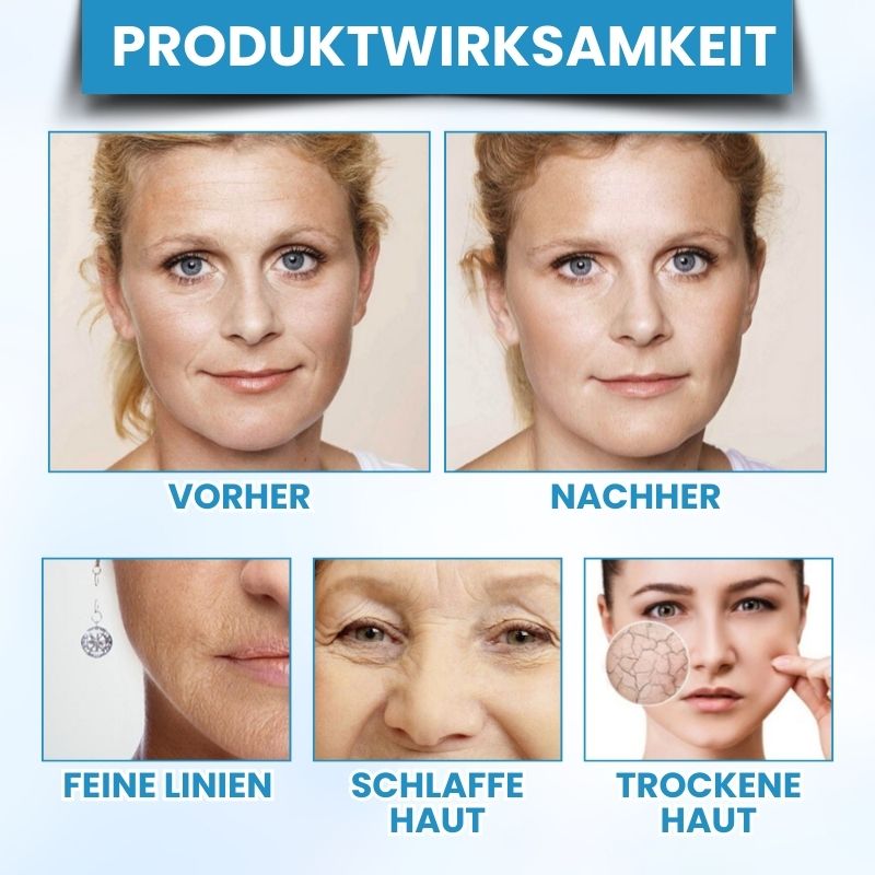 SkinRevive™ | Strafft die Haut in 72 Stunden