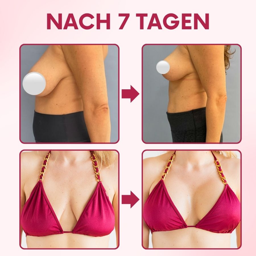 Curvea™ | Bruststraffungs-Pflaster