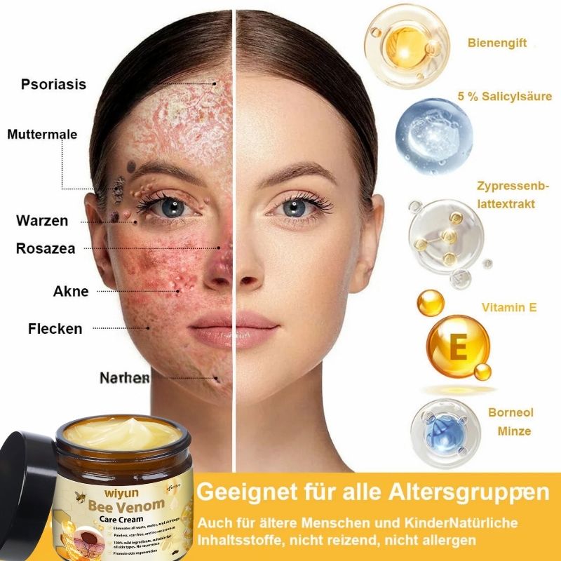 HautRepar™ | Leistungsstarke Ganzkörper-Hautpflegecreme (EADV-Empfehlungen)