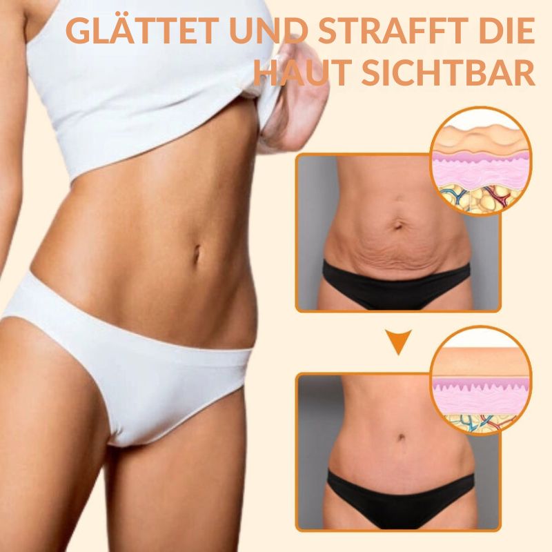 FestBauch™ | Bauchstraffende Creme
