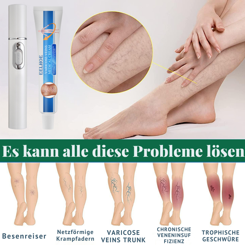 VaricoseKlar™ | Vollständige Beseitigung von Krampfadern in nur 4 Wochen!