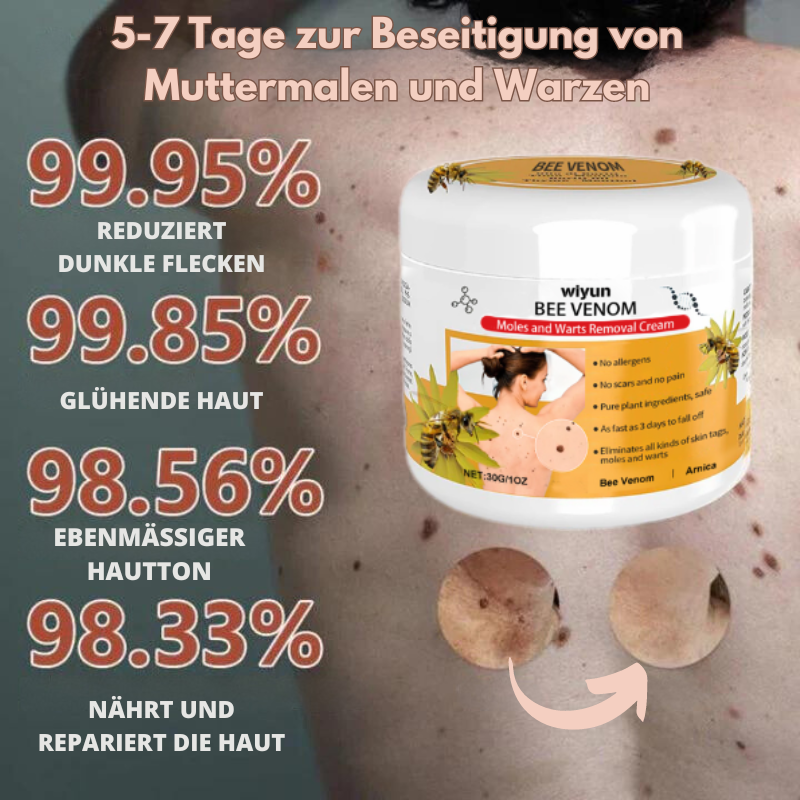 HautKlar™ | Beseitigen Sie lästige Hautwarzen in nur 1-3 Wochen!