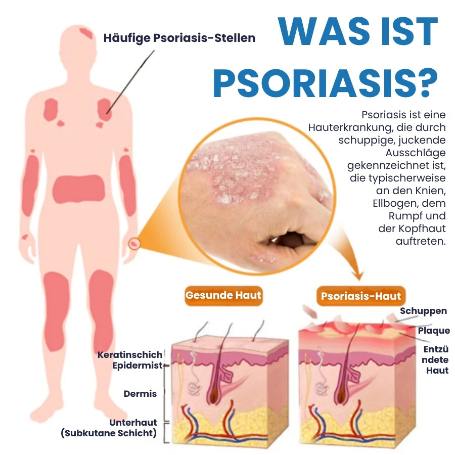 DermaBoost™ | Psoriasis und Ekzem Kräuter‑Beruhigungsspray