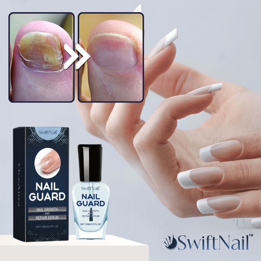 SwiftNail™ | Nagelreparatur-Serum