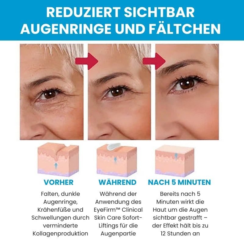 EyeFirm™ - Creme | Reduziert Schwellungen und Fältchen in 5 Minuten