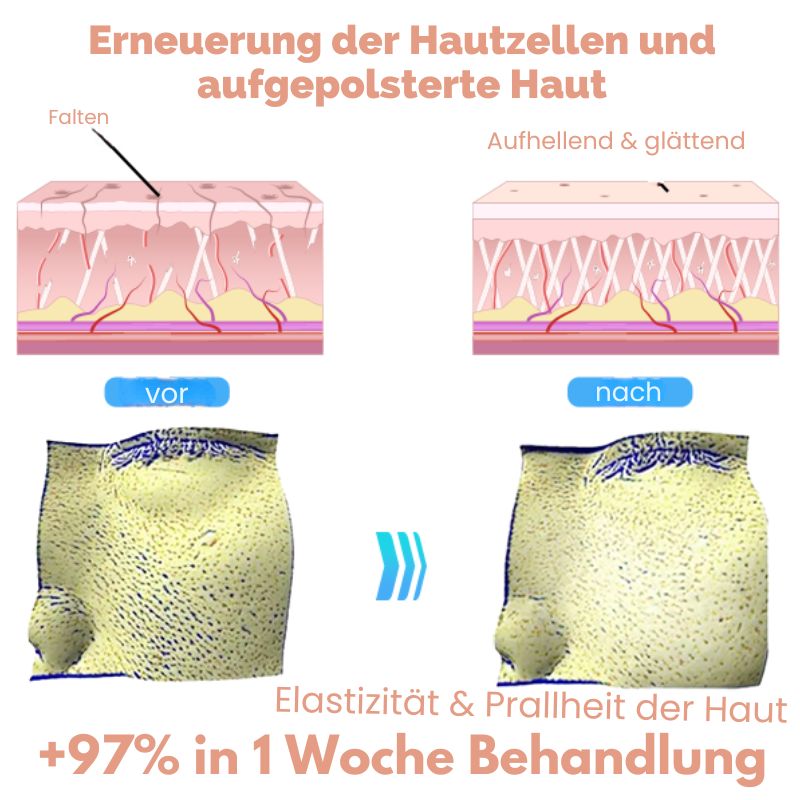 EMSGesichtsTon™ | EMS-Sculpting-Schönheitsgerät