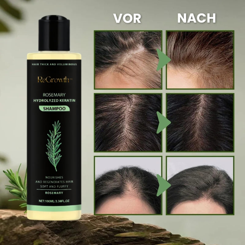 ReGrowth™ | Bio-Rosmarin-Haarwuchsshampoo