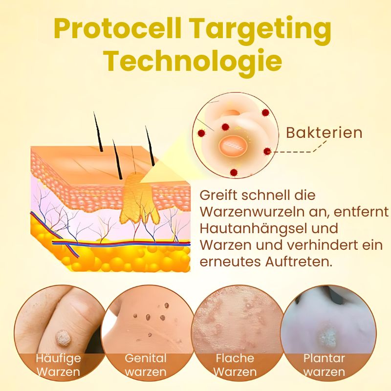 WarzenFix™ | Bienenstich-Reparatur- und Feuchtigkeitscreme