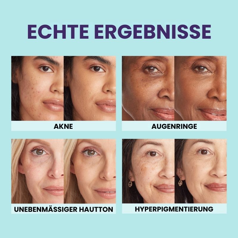 GlowVeil™ | Concealer für Gesicht & Körper