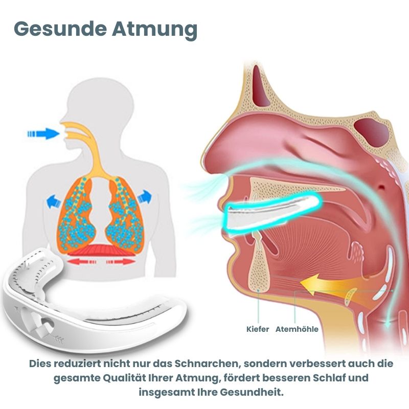 StilleNight™ | Apnea Oral Appliances