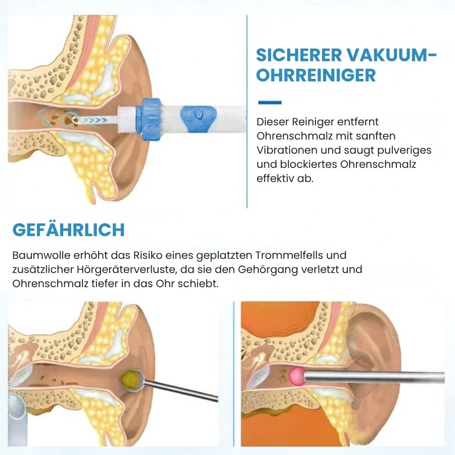 Aurix™ | Ohrreinigungsgerät