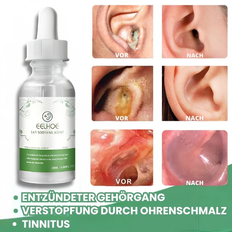 TinniTropfen™ | Organische Kräutertropfen gegen Tinnitus