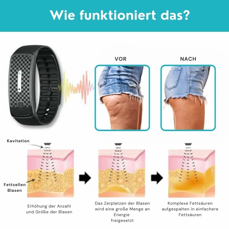 CelluKlar™ | Ultraschall-Bänder zur Cellulite-Entfernung und Entgiftung