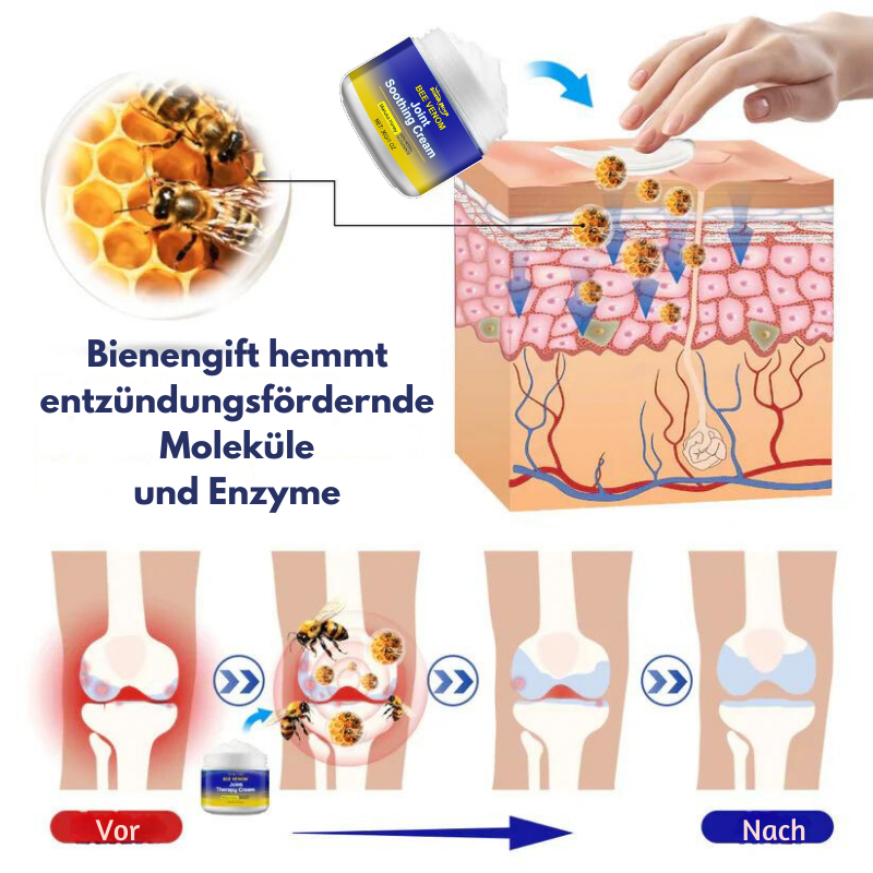 GelenkPro™ | Linderung von Gelenksteifheit und Schwellungen in nur wenigen Wochen!