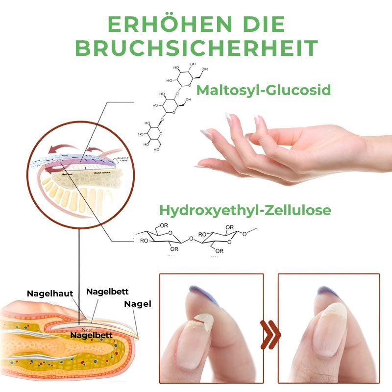 NagelKur™ | Nagelpflegegel