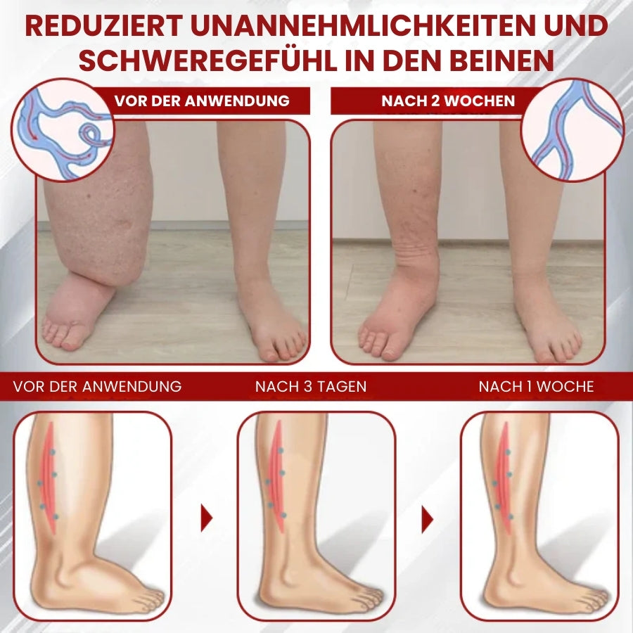 FluidRelief™ | Rote-Weinrebe Ödem Gel