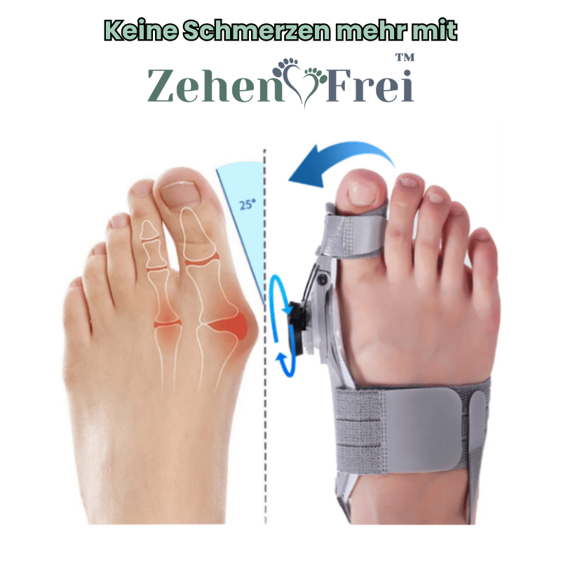 ZehenFrei™ | Lindern Sie jahrelange Ballenzehen bei täglicher Anwendung in nur 30 Minuten!