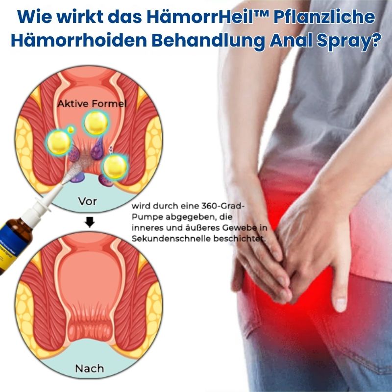 HämorrHeil™ | Hämorrhoiden Kräuterspray