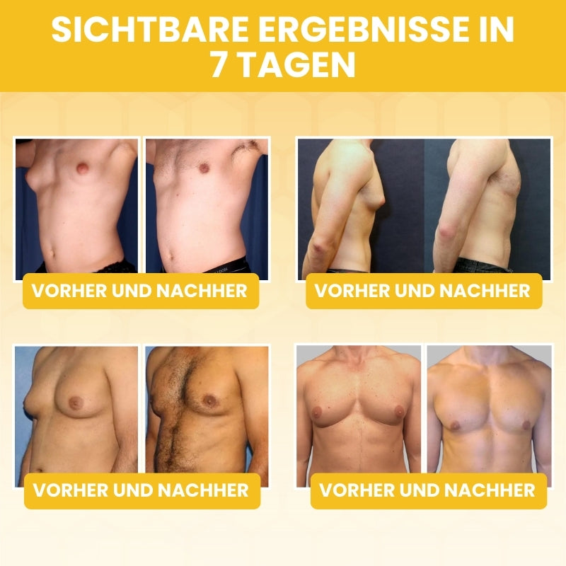ZeroGyno™ | Bienengift-Serum gegen Gynäkomastie bei Männern