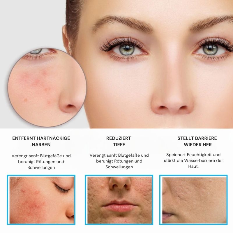 RadiantHaut™ | Hautglättendes Serum