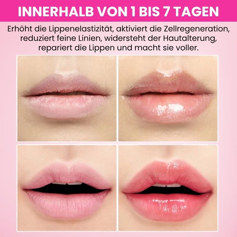VitaLips® | Lippenserum-Stift