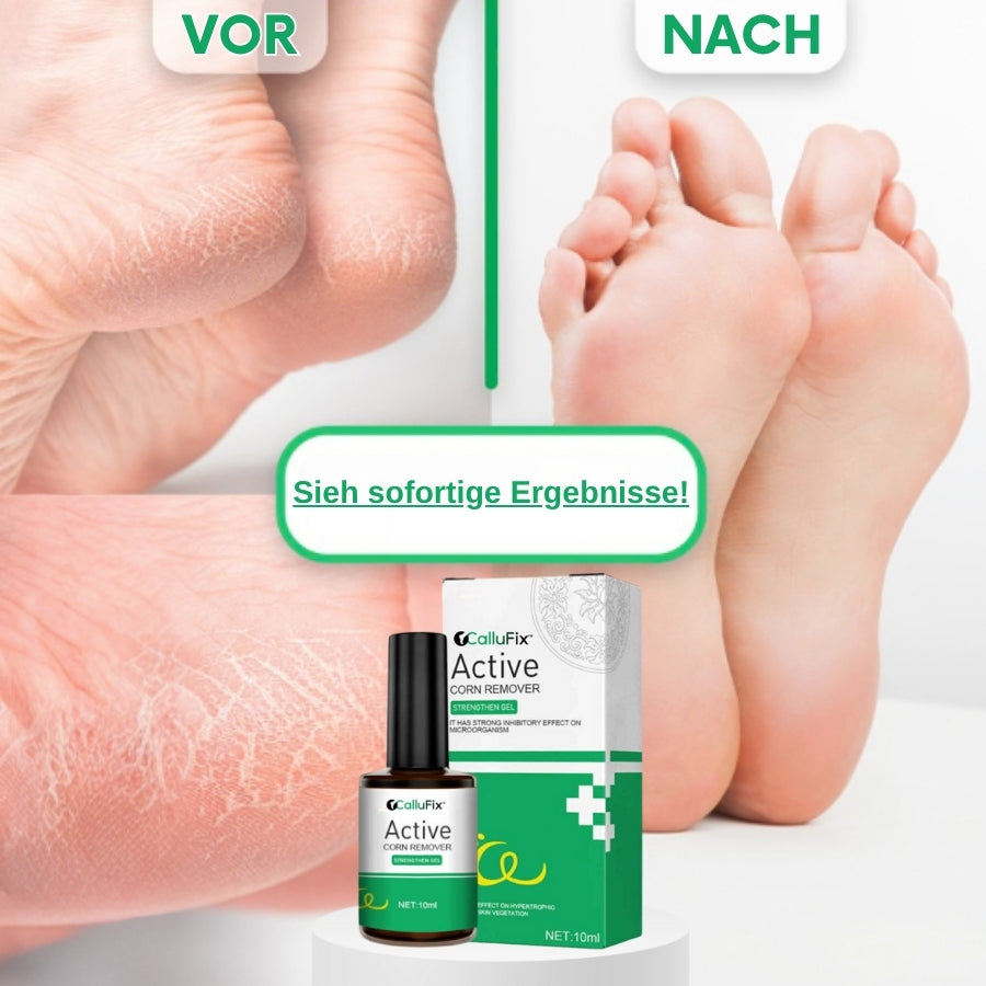 CalluFix™ | Aktives Hornhautentferner-Gel