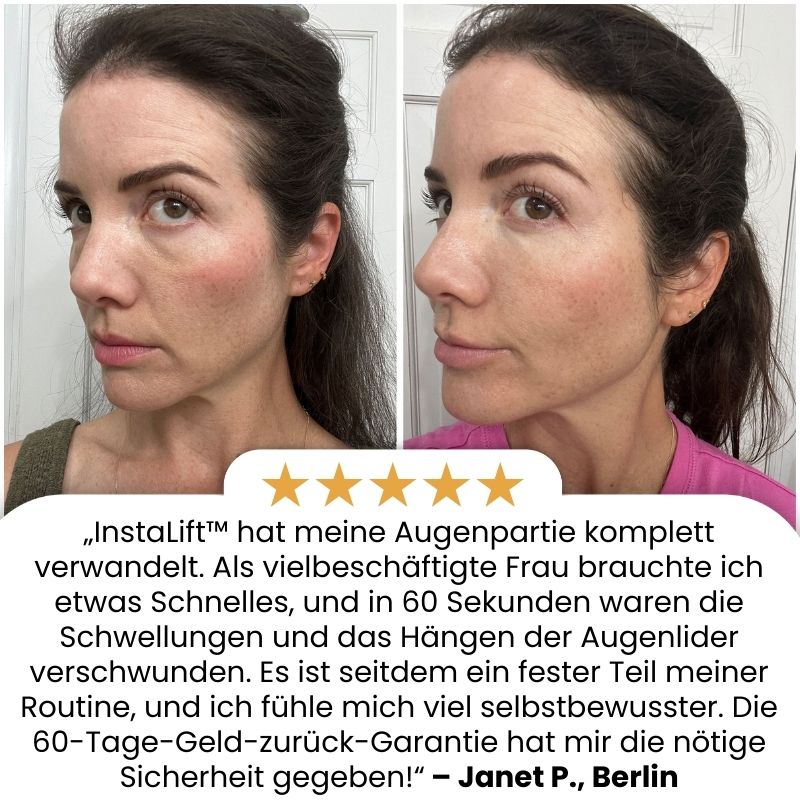 InstaLift™ | Temporärer Sofort-Straffer